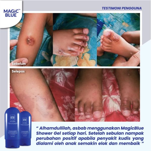 Combo Shower Gel Bidara & Habbatus Sauda - Image 5